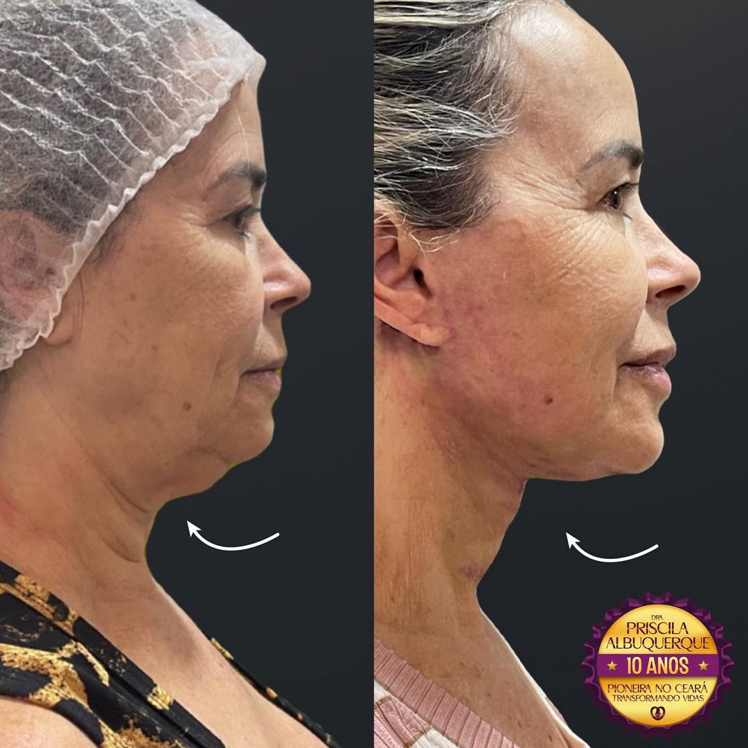 369395622_18394631176049019_6909950734939950341_n