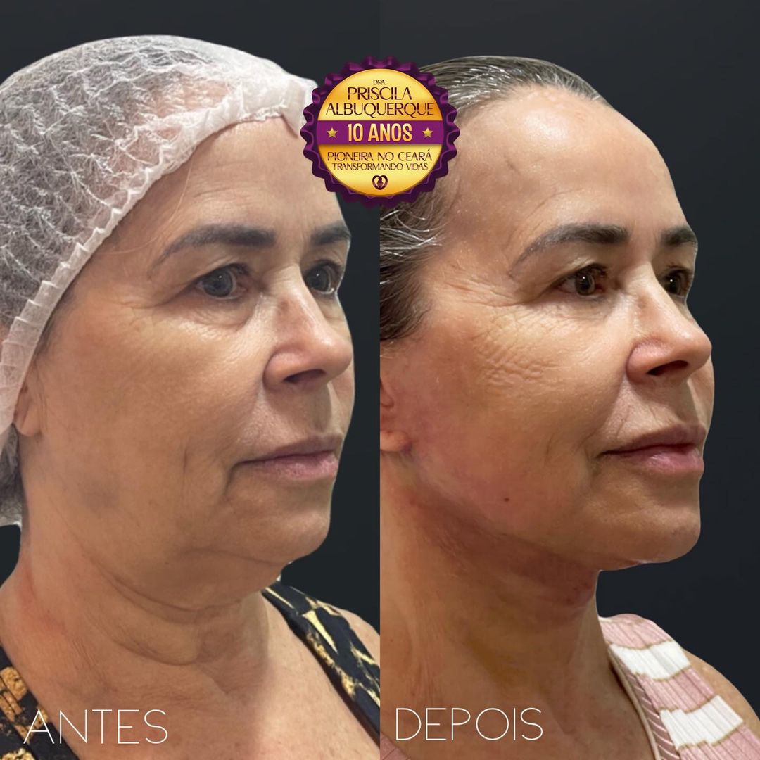 370479678_18394631158049019_9006458669968763891_n